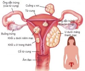 Dich Vu Y Te Tai Nha Binh Duong ̀5
