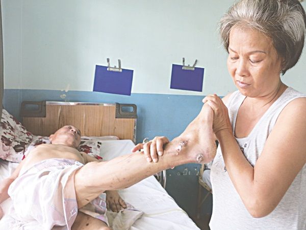 Thay Băng Loét Cho Người Già Bình Dương